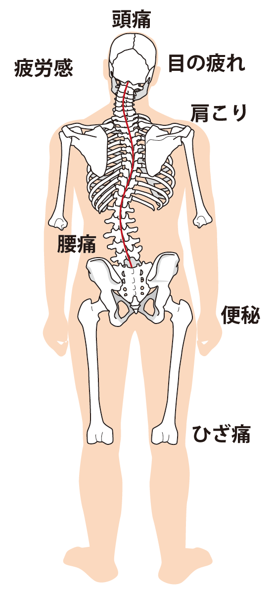 肩こりへのアプローチは？